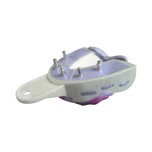Hager 101252 Miratray Implant Advanced Impression Tray Upper S2 Medium 6/Pk Hager 101252 Miratray Implant Advanced Impression Tray Upper S2 Medium 6/Pk